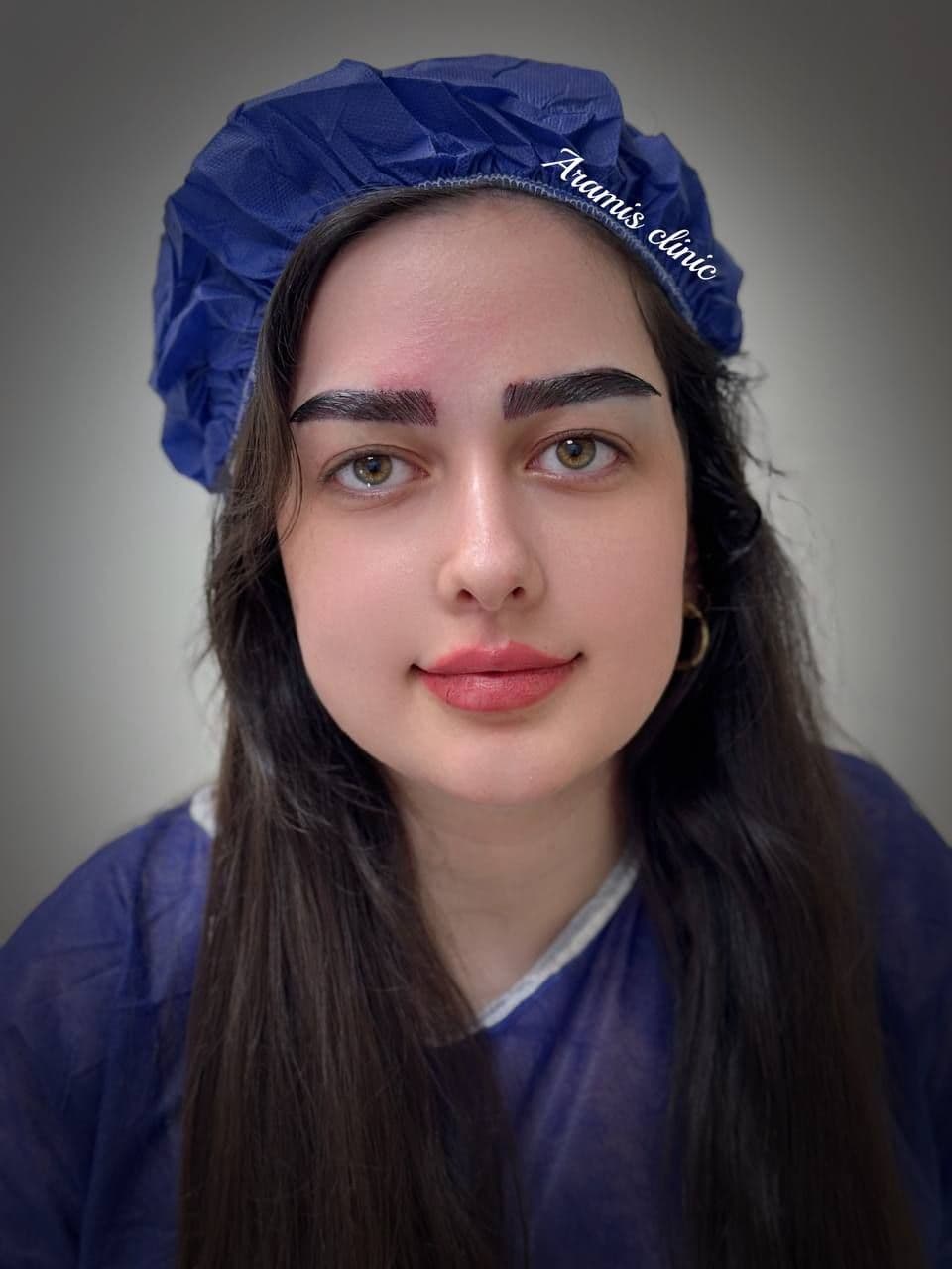 کاشت ابرو
