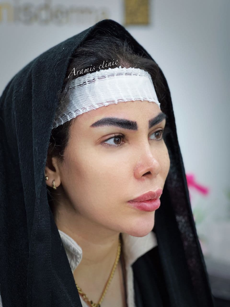 بعد - 2