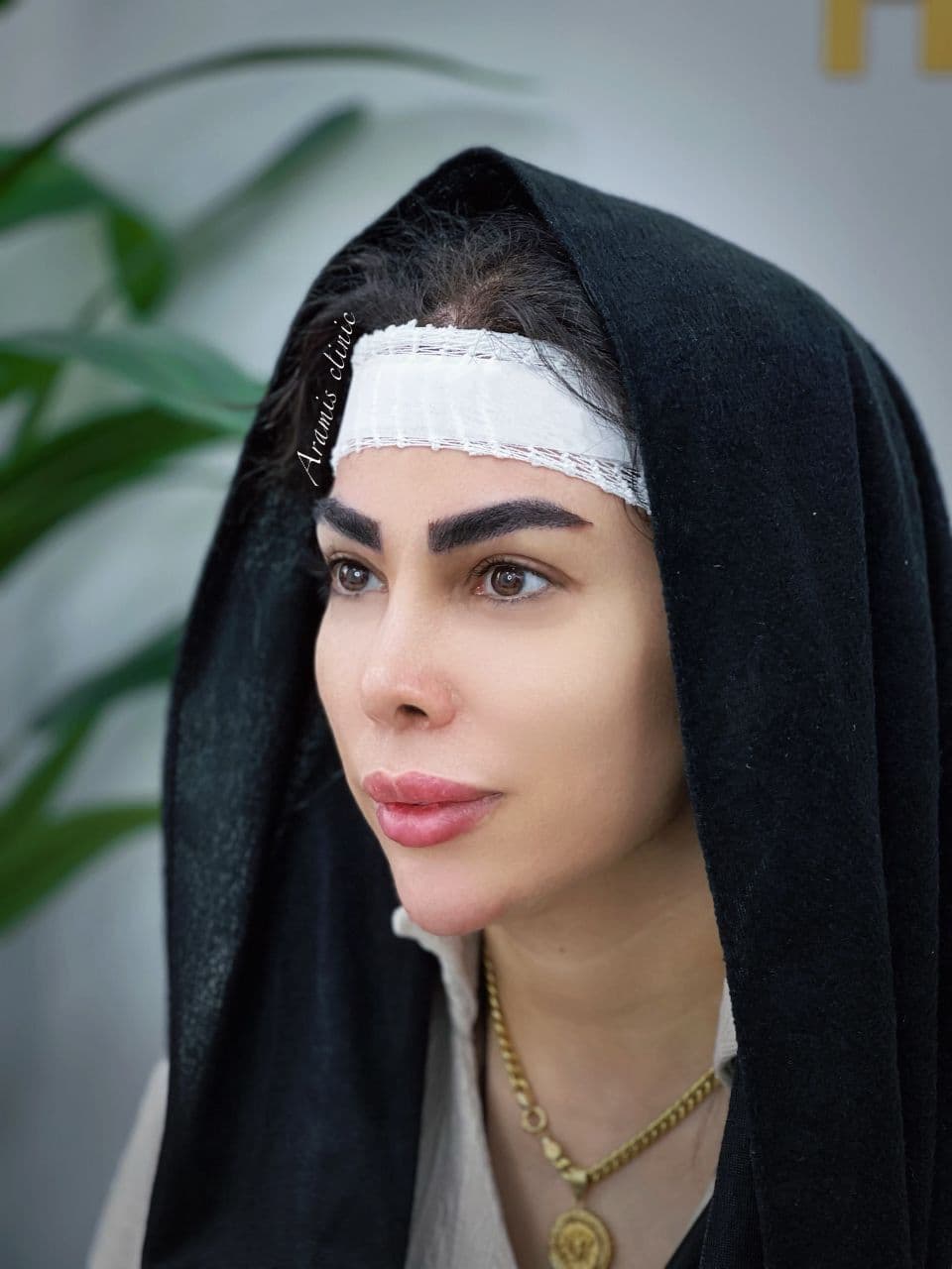 بعد - 3