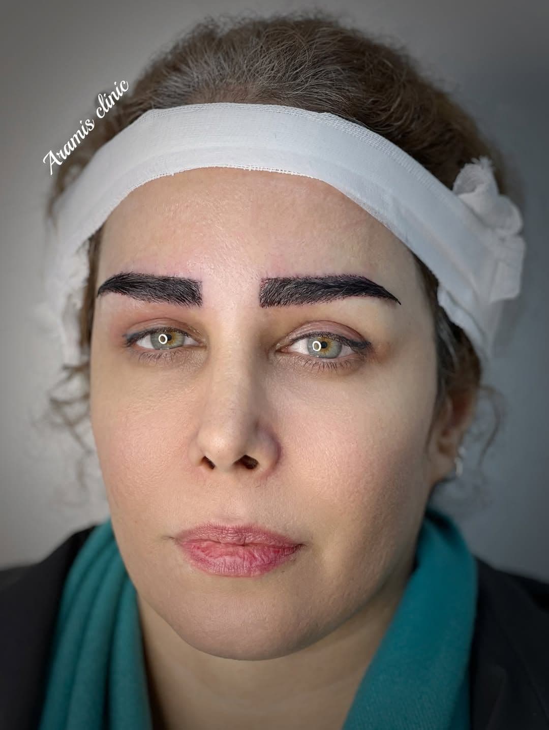 بعد - 1