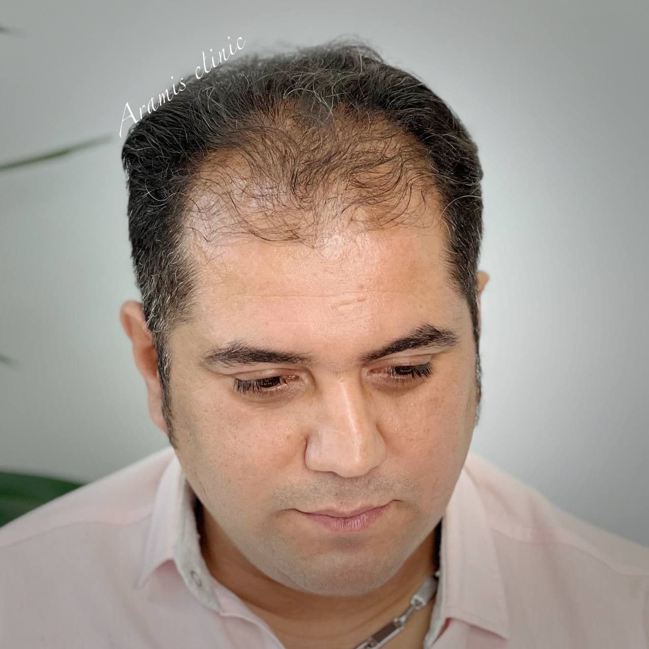 قبل - 1