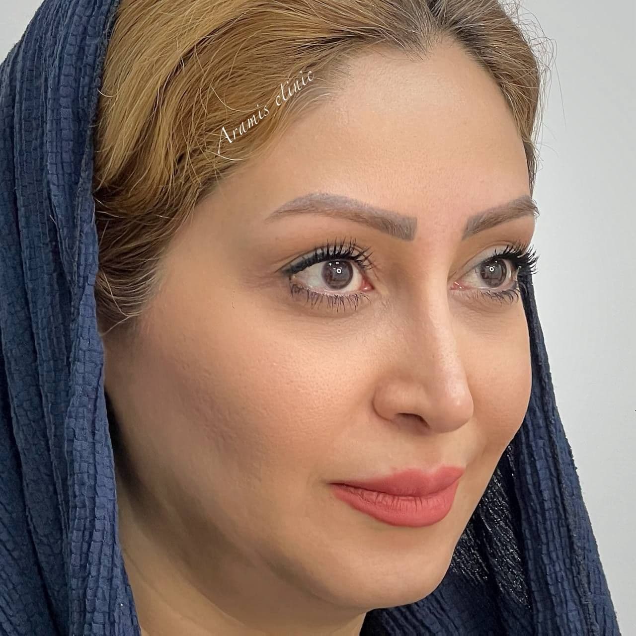 قبل - 1