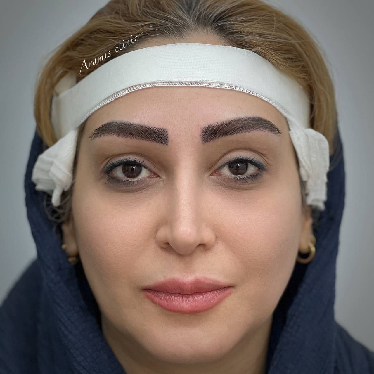 بعد - 2