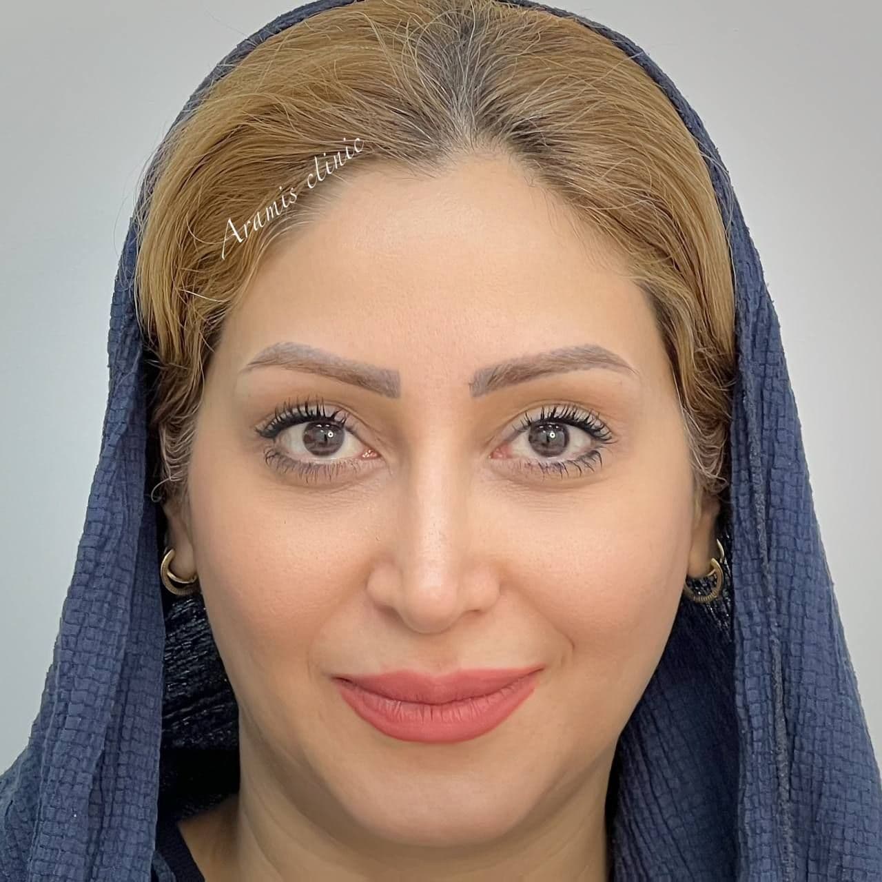 قبل - 2
