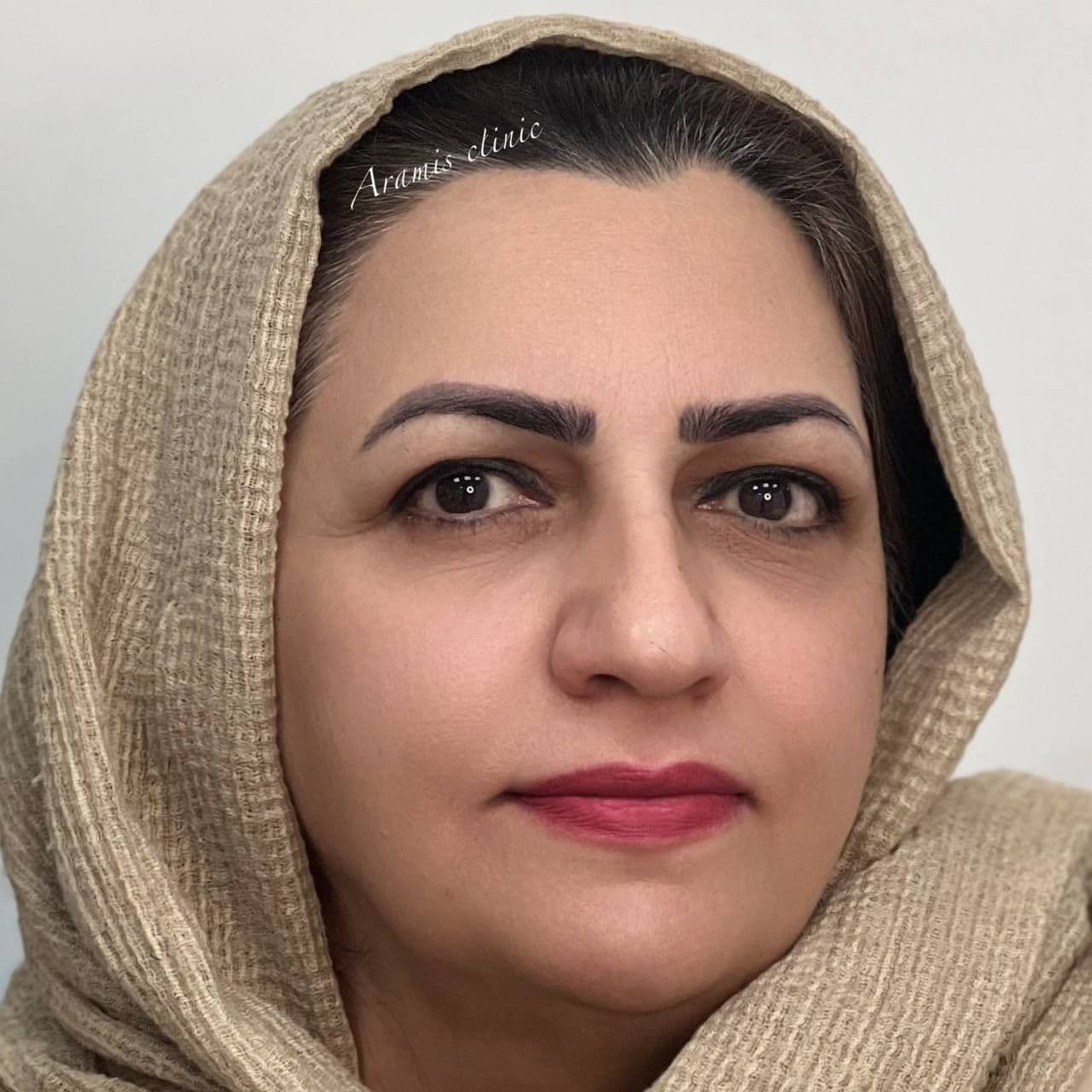 قبل - 2