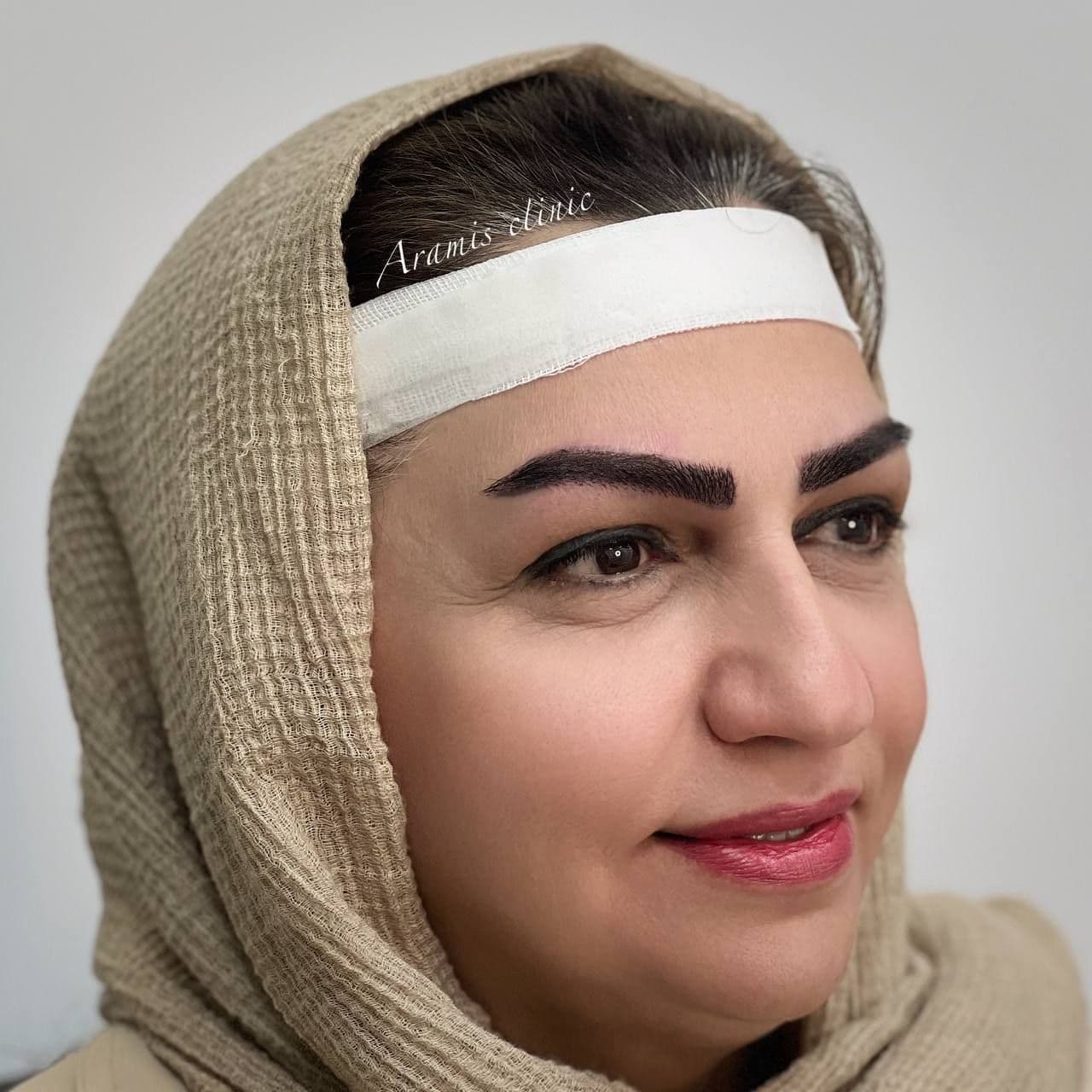 بعد - 3
